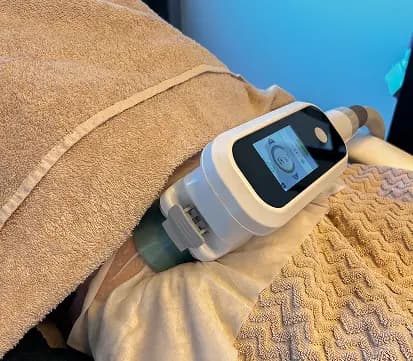 Cryo behandeling in praktijkruimte